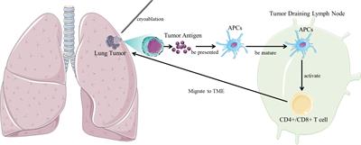 Frontiers Cryoablation And Immune Synergistic Effect For Lung Cancer